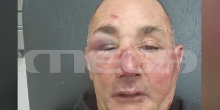 Ρόδος: Ξυλοκόπησαν άγρια και λήστεψαν χρυσοχόο – «Έλεγα ότι θα πεθάνω»