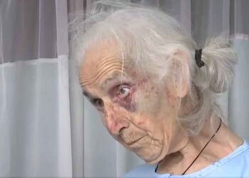 Αγγελόκαστρο Αγρινίου: Τι αναφέρει η 85χρονη που την ξυλοκόπησαν άγρια στο σπίτι της για 100 ευρώ (video)