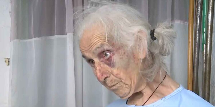 Αγγελόκαστρο Αγρινίου: Τι αναφέρει η 85χρονη που την ξυλοκόπησαν άγρια στο σπίτι της για 100 ευρώ (video)