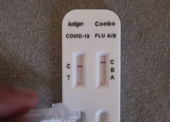 ΕΟΔΥ: Έξι θάνατοι και 99 εισαγωγές από κορονοϊό την τελευταία εβδομάδα – Ένας ασθενής σε ΜΕΘ με γρίπη