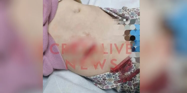 Ηράκλειο: Κοριτσάκι 4,5 χρόνων έπεσε σε φρεάτιο γεμάτο με κοφτερές λαμαρίνες – Τραυματίστηκε στην κοιλιά